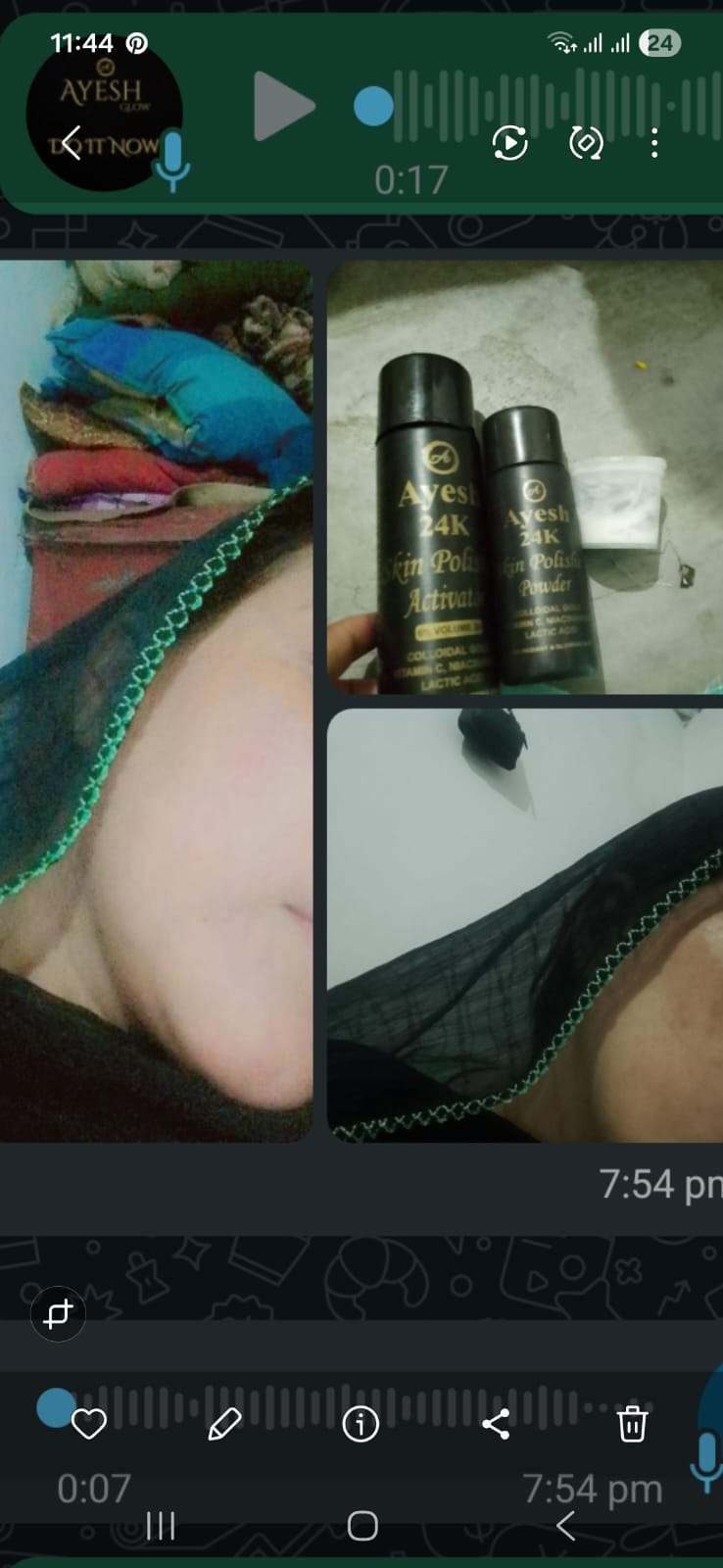 Skin Polish : Before & After