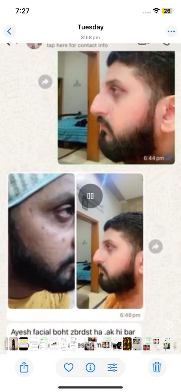 Skin Polish Before & After