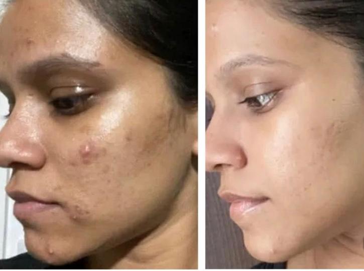 Ayesh Glow Skin Routein Kit