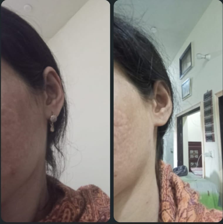 Facial Kit