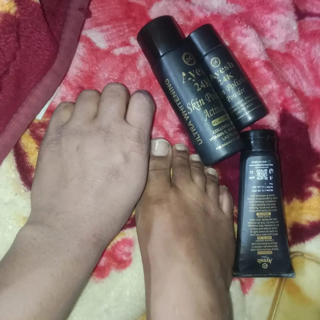 Skin Polish : Before & After